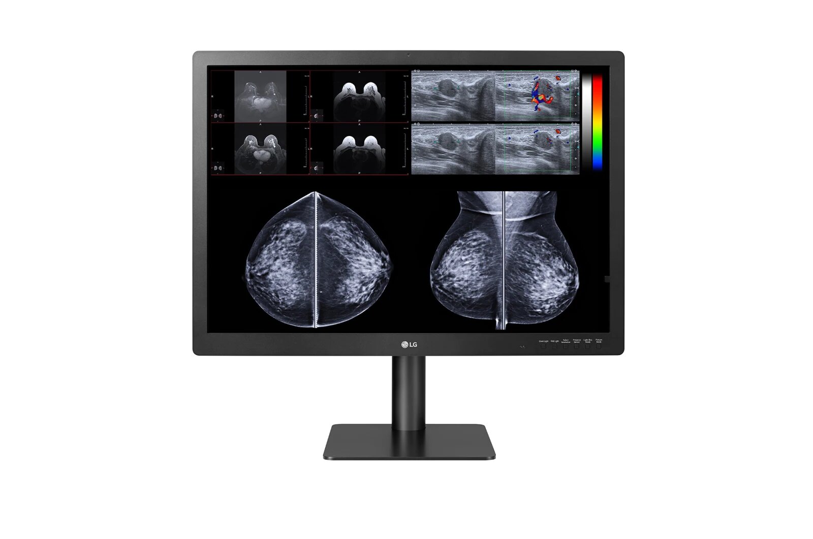 31HN713D Medical Monitor