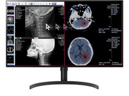 Monitor médico 32HL512D